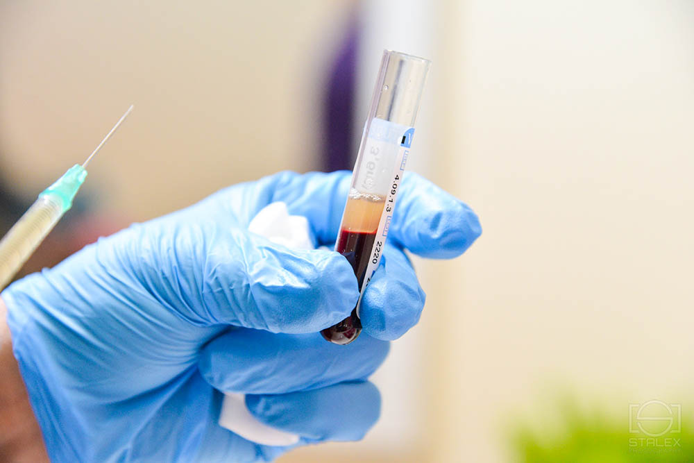 PRP – PLATELET RICH PLASMA
